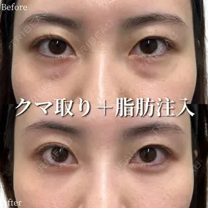 ライブリークリニック 浜松町院 林 政男医師の症例