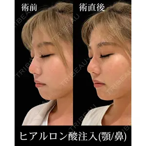 HAAB×DREAM BEAUTY CLINIC 東京本院 佐野 圭医師の症例