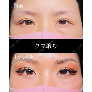 HAAB×DREAM BEAUTY CLINIC 大阪梅田院 柏木 太雅医師の症例
