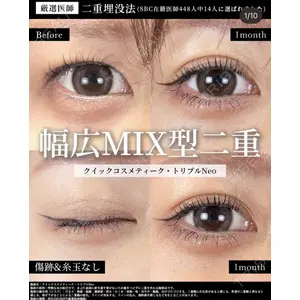 湘南美容クリニック 大阪梅田院 横谷 仁彦医師の症例