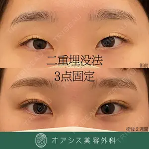 オアシス美容外科 遠藤 剛史医師の症例