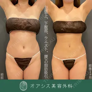 オアシス美容外科 遠藤 剛史医師の症例