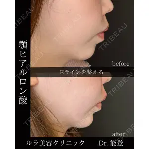 ルラ美容クリニック 新潟院 能登 貴弘医師の症例