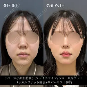 RIVER CLINIC（リバークリニック）の症例
