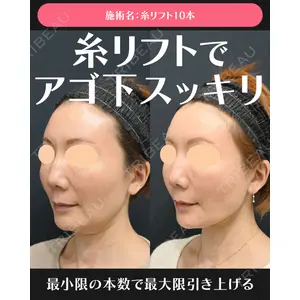 湘南美容クリニック 川崎院 伊藤 賀敏医師の症例
