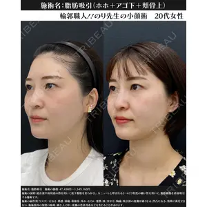 湘南美容クリニック 川崎院 伊藤 賀敏医師の症例