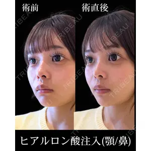 HAAB×DREAM BEAUTY CLINIC 東京本院 佐野 圭医師の症例