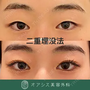 オアシス美容外科 遠藤 剛史医師の症例