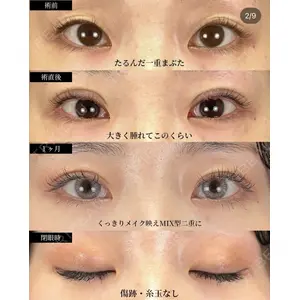 湘南美容クリニック 大阪梅田院 横谷 仁彦医師の症例