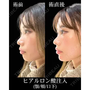 HAAB×DREAM BEAUTY CLINIC 東京本院 佐野 圭医師の症例