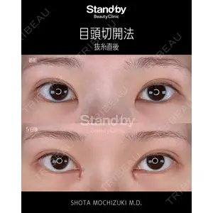 Stand by Beauty Clinic 望月 聖太医師の症例