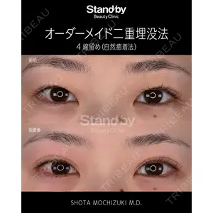 Stand by Beauty Clinic 望月 聖太医師の症例