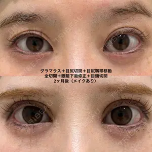 エターナル美容クリニック 久門田 詳医師の症例