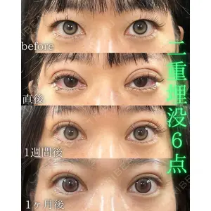 THE FIRST CLINIC 町田院 木暮 啓一郎医師の症例