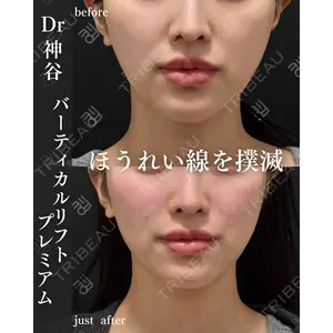 EMMO FACE CLINIC 大阪梅田院 神谷 一成医師の症例