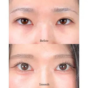 東京シンデレラ美容外科 池袋院 山本 紘子医師の症例