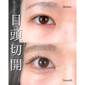 東京シンデレラ美容外科 池袋院 山本 紘子医師の症例