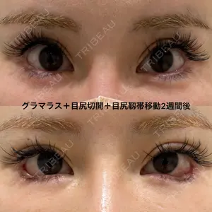 エターナル美容クリニックの症例