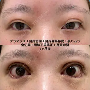 エターナル美容クリニック 久門田 詳医師の症例