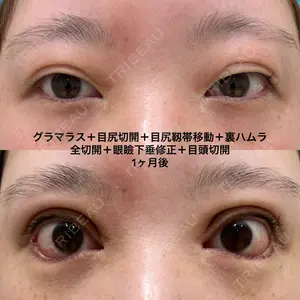 エターナル美容クリニック 久門田 詳医師の症例