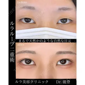 ルラ美容クリニック 札幌院 能登 貴弘医師の症例