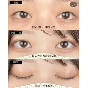 湘南美容クリニック 大阪梅田院の症例