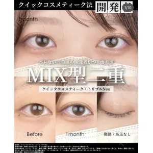 湘南美容クリニック 大阪梅田院の症例