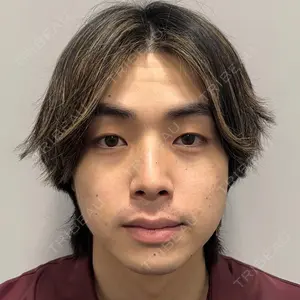 Days Beauty Clinicの症例