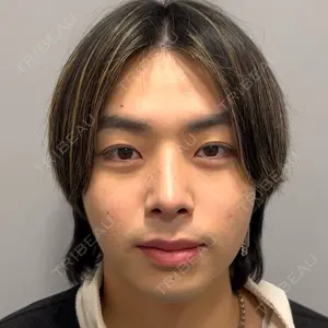 Days Beauty Clinicの症例