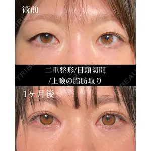 HAAB BEAUTY CLINIC 名古屋院 丸山 舜大医師の症例