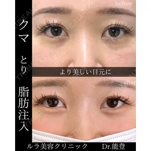 ルラ美容クリニック 札幌院 能登 貴弘医師の症例