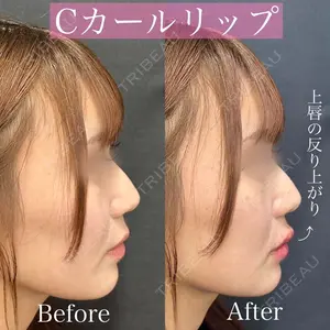 ルラ美容クリニック 渋谷本院 昼間 路子医師の症例