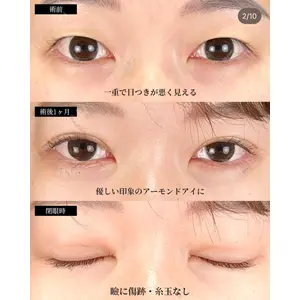湘南美容クリニック 大阪梅田院 横谷 仁彦医師の症例