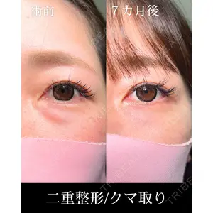 HAAB×DREAM BEAUTY CLINIC 大阪梅田院 鈴木 馨斗医師の症例