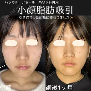 ルラ美容クリニック 仙台院 橋本 英樹医師の症例