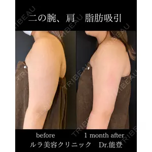 ルラ美容クリニック 札幌院 能登 貴弘医師の症例