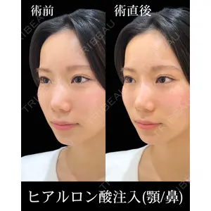 HAAB×DREAM BEAUTY CLINIC 東京本院 佐野 圭医師の症例