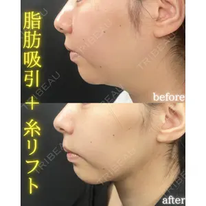 THE FIRST CLINIC 町田院 木暮 啓一郎医師の症例