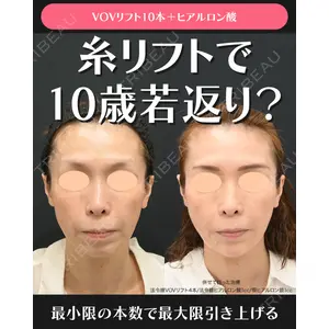 湘南美容クリニック 川崎院 伊藤 賀敏医師の症例