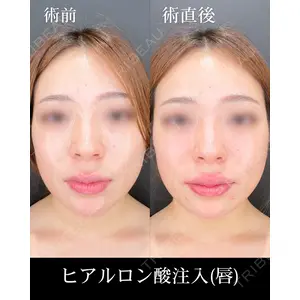 HAAB×DREAM BEAUTY CLINIC 大阪梅田院 錦 実奈医師の症例