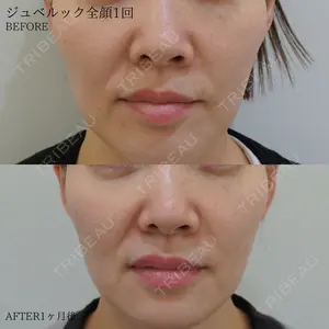 ATELIERMedicalClinic 古市　ゆり医師の症例