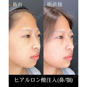 HAAB×DREAM BEAUTY CLINIC 大阪梅田院 柏木 太雅医師の症例