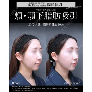ヴェルトラクリニック 大阪院 河中聡之医師の症例