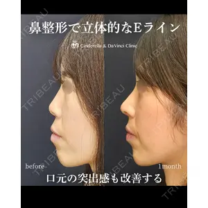 シンデレラ＆ダヴィンチクリニック 宮田 洋佑医師の症例