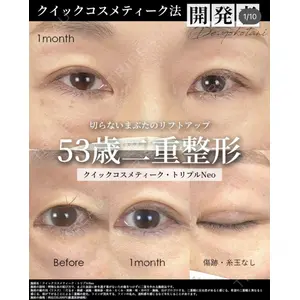 湘南美容クリニック 大阪梅田院 横谷 仁彦医師の症例