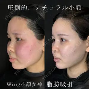 Wing clinic 豊中駅前院 速水 翼医師の症例