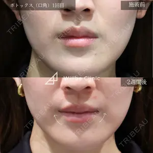 ウィルビークリニック 銀座院の症例