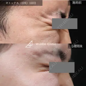 ウィルビークリニック 銀座院の症例