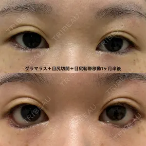 エターナル美容クリニック 久門田 詳医師の症例
