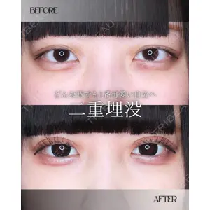 小倉美容外科/美容皮膚科 ビラビューティークリニック 大村 亞蘭医師の症例